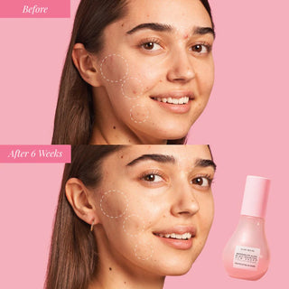 Glow Recipe Watermelon Glow Niacinamide Dew Drops Serum Mini 15ml